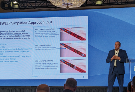 iCHOR Vascular: Innovating Simplified Thrombectomy Solutions